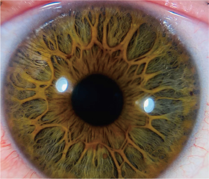 Eye Imaging Adaptor QuikVue Plus VPA-200