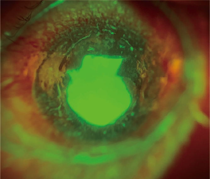 Eye Imaging Adaptor QuikVue Plus VPA-200