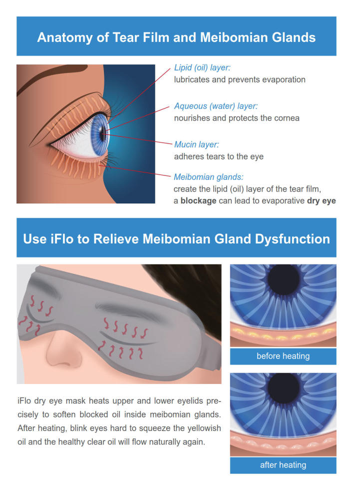 Free Dry Eye Educational Brochures