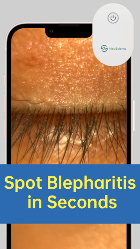 Eye Imaging Adaptor QuikVue Plus VPA-200