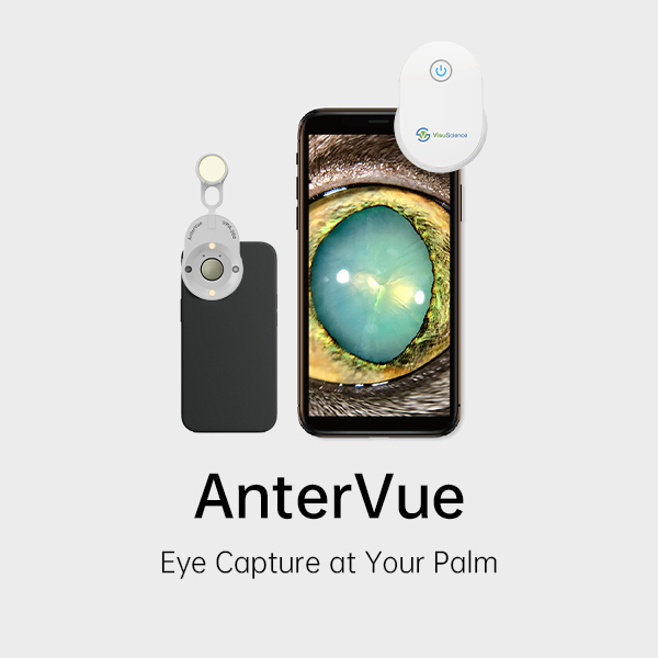 Eye Imaging Adaptor AnterVue Plus VPA-200