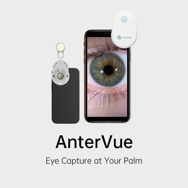 Eye Imaging Adaptor AnterVue VPA-200