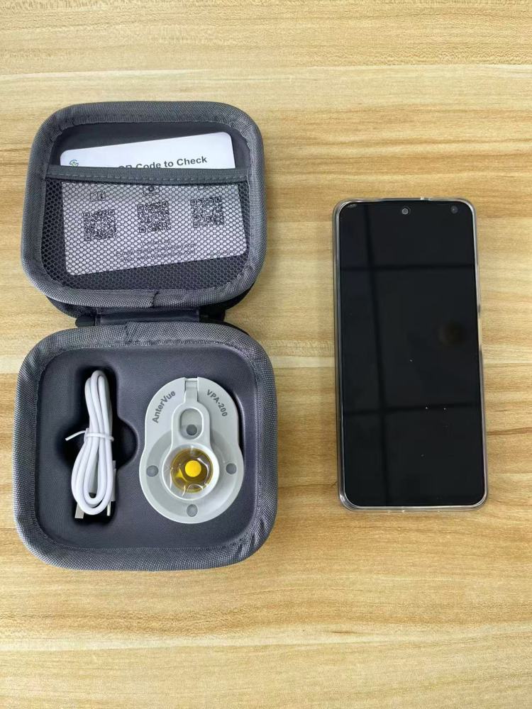 Dry Eye Screening Pack – AnterVue + MeiboVue + Smartphone + VisuDoc