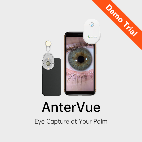 AnterVue VPA-200 – 7-Day Trial (U.S. Market)
