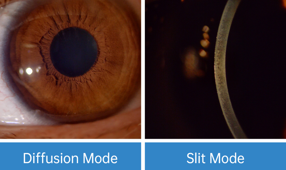 EyeStream Slit Lamp Camera Module
