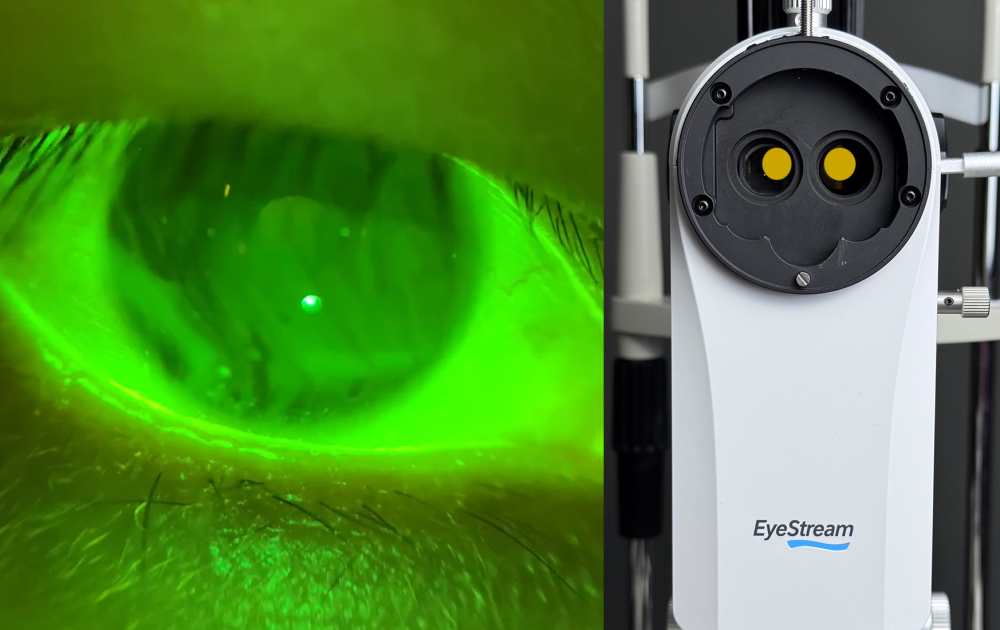 EyeStream Slit Lamp Camera Module