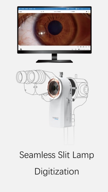 EyeStream Slit Lamp Camera Module – 7-Day Trial (U.S. Market)
