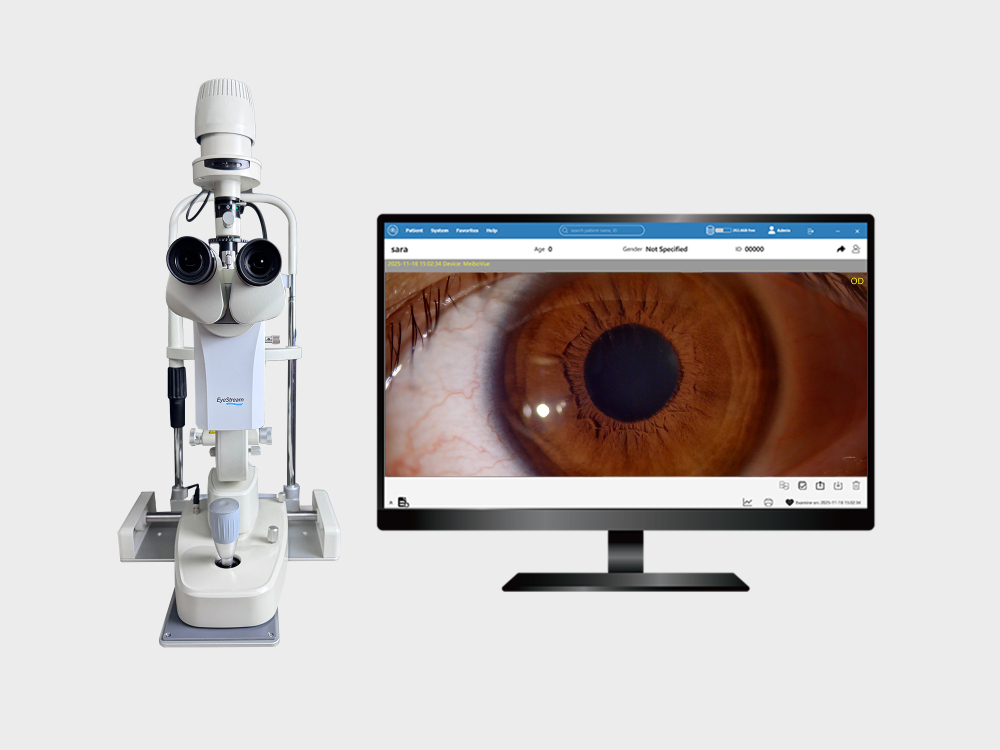 EyeStream Slit Lamp Camera Module – 7-Day Trial (U.S. Market)