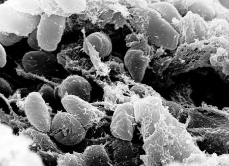 Yersinia pestis causing multiple plagues  