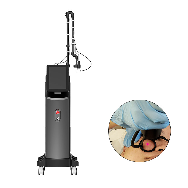 CO2 Fractional Laser Machine – Advanced Skin Resurfacing & Scar Removal,emmalaser,CO2 Fractional Laser Machine – Advanced Skin Resurfacing & Scar Removal