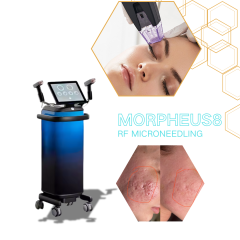 Best Morphues8 RF Microneedling Device For Sale: Advanced Skin Rejuvenation & Tightening Solution,emmalaser,Best Morphues8 RF Microneedling Device For Sale: Advanced Skin Rejuvenation & Tightening Solution