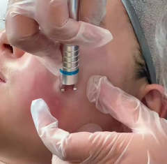 EVLT 980nm Diode Laser Vascular Removal | Professional Spider Vein Treatment Device,emmalaser,980nm Diode Laser Vascular Removal Machine | Spider Vein Treatment Device