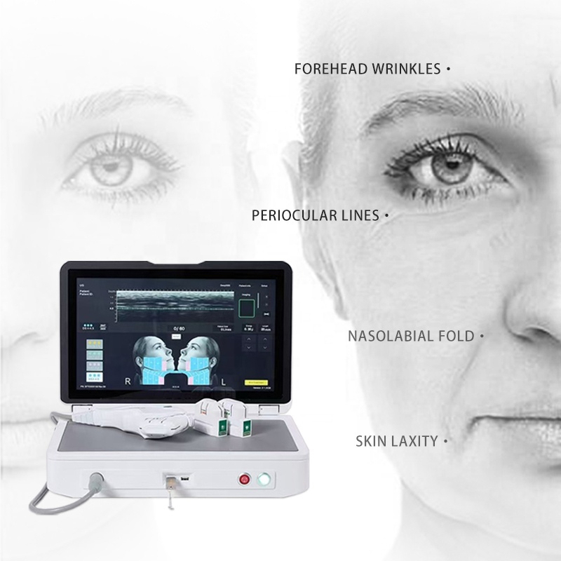 Latest Generation Prime HIFU Machine | Non-Surgical Face Lifting & Skin Tightening,emmalaser,Latest Generation Prime HIFU Machine | Non-Surgical Face Lifting & Skin Tightening