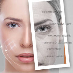 Latest Generationo Prime HIFU Machine | Non-Surgical Face Lifting & Skin Tightening,emmalaser,Latest Generationo Prime HIFU Machine | Non-Surgical Face Lifting & Skin Tightening