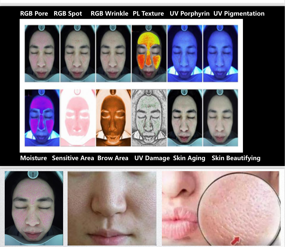 https://emmalaser.com/products/visichange-3-spectrum-ai-skin-analyzer-machine