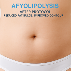 360 Cryolipolysis Fat Freezing,emmalaser,360 Cryolipolysis Fat Freezing