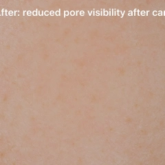 Visichange 3-Spectrum Skin Analyzer with AI-Based Facial Detection & Cloud Management,emmalaser,Visichange 3-Spectrum Skin Analyzer with AI-Based Facial Detection & Cloud Management