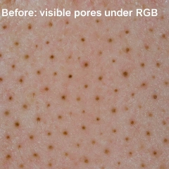 Visichange 3-Spectrum Skin Analyzer with AI-Based Facial Detection & Cloud Management,emmalaser,Visichange 3-Spectrum Skin Analyzer with AI-Based Facial Detection & Cloud Management