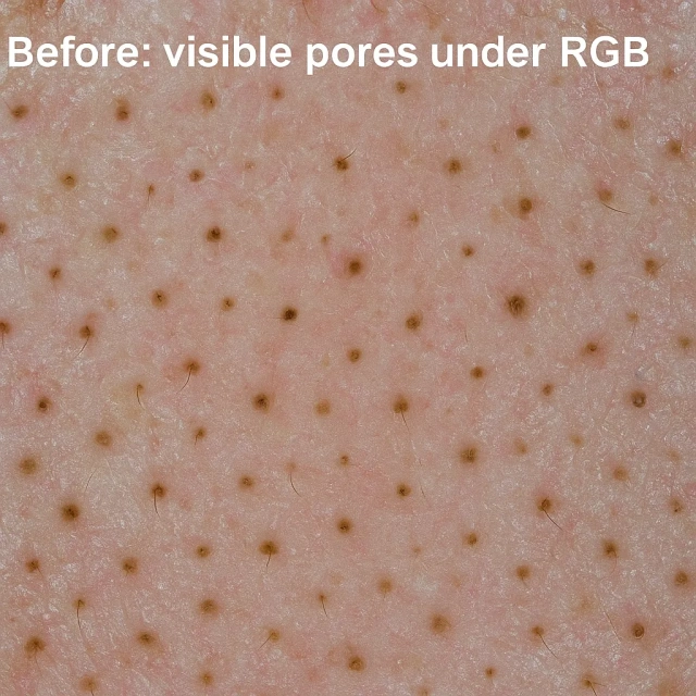 Visichange 3-Spectrum Skin Analyzer with AI-Based Facial Detection & Cloud Management,emmalaser,Visichange 3-Spectrum Skin Analyzer with AI-Based Facial Detection & Cloud Management