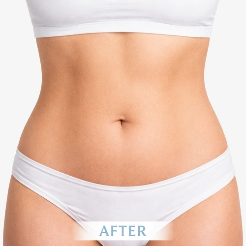 360 Coolplas Pro | Professional 360° Fat Freezing Machine,emmalaser,360 Coolplas Pro | Professional 360° Fat Freezing Machine