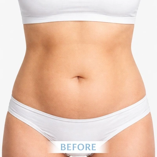 360 Coolplas Pro | Professional 360° Fat Freezing Machine,emmalaser,360 Coolplas Pro | Professional 360° Fat Freezing Machine