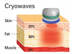 Vertical Cold Wave Shaping Machine| 2.45GHz Microwave Fat Melting,emmalaser,Vertical Cold Wave Shaping Machine| 2.45GHz Microwave Fat Melting