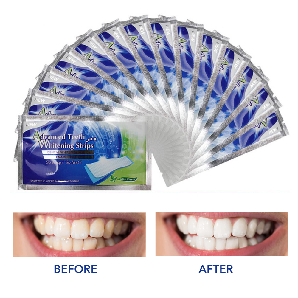 Wholesale Teeth Whitening Strips _Green Style Best Selling on Amazon Temu Shein