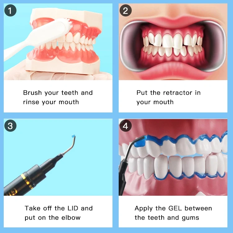 IVISMILE Professional Dental Gum Protector Teeth Whitening Gingival Protective Barrier Gel