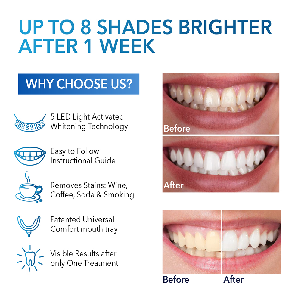 Wholesale 3 Teeth Whitening Gel Remove Stains 10 Min Non-Sensitive Fast Teeth Whitener LED Light Teeth Whitening Kit