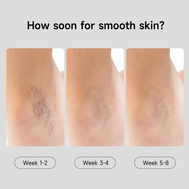 Recharge Painless IPL Hair Remover device Home Use Ipl machine With Sapphire freezing point Epilator for women