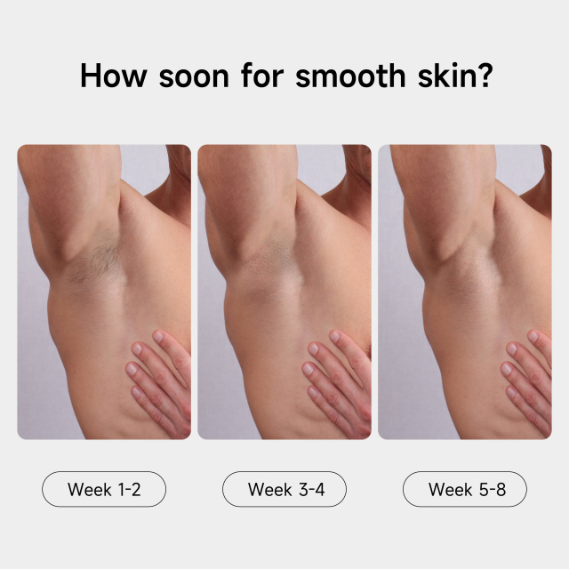 Factory Customized ipl hair removal machine home use beauty equipment portable IPL hair removal laser device for skin care