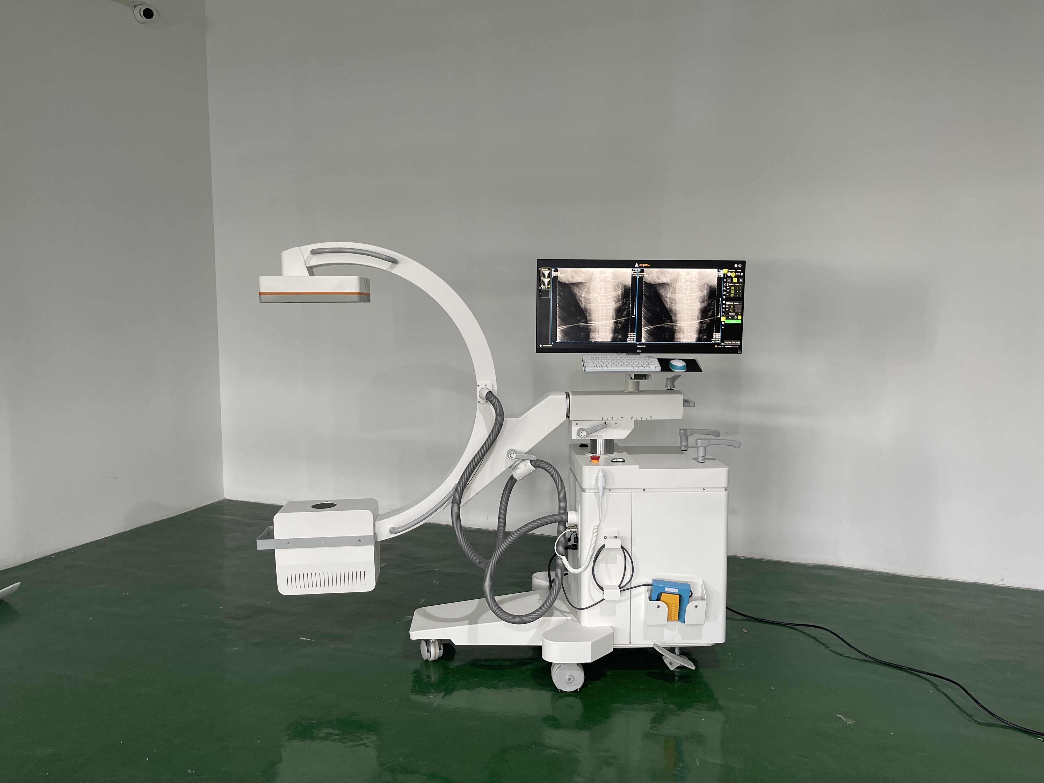 INC-15kW Mobile C-arm X-ray Machine(Flat-panel Detector)