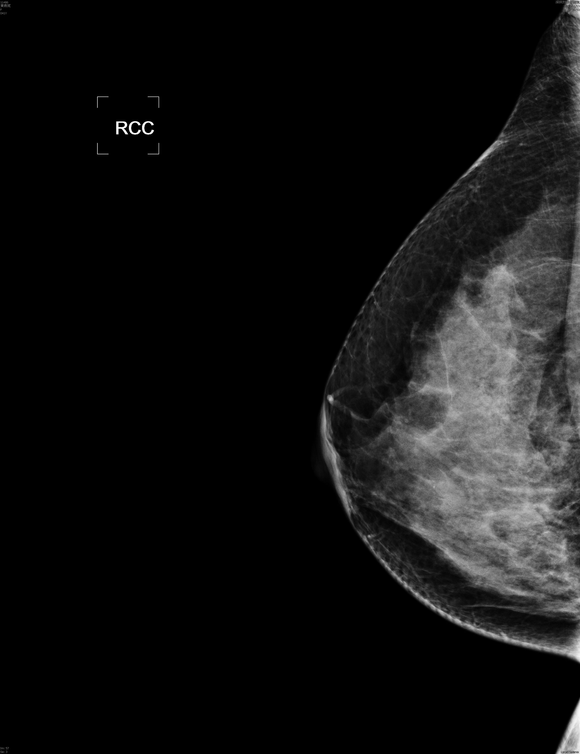 INM-5kW Digital Mammography X-ray System