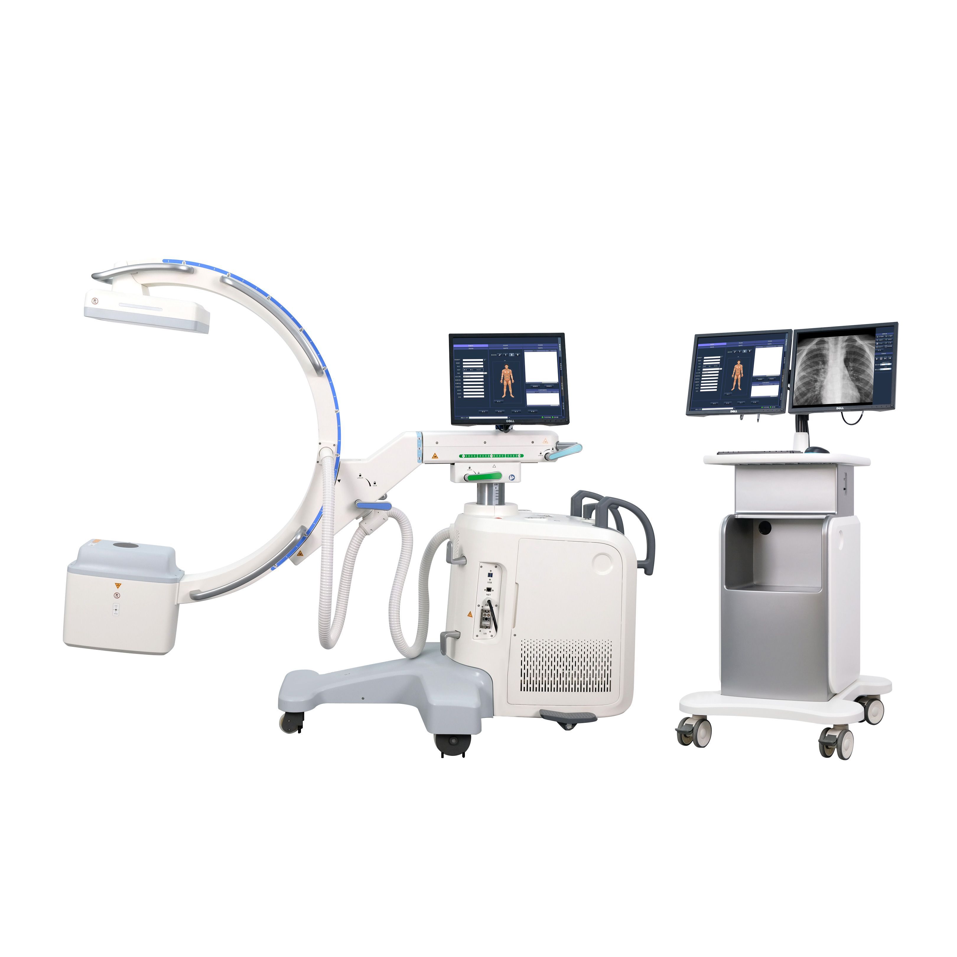 MCX-C605F 5.0kW High Frequency C-arm X-ray System