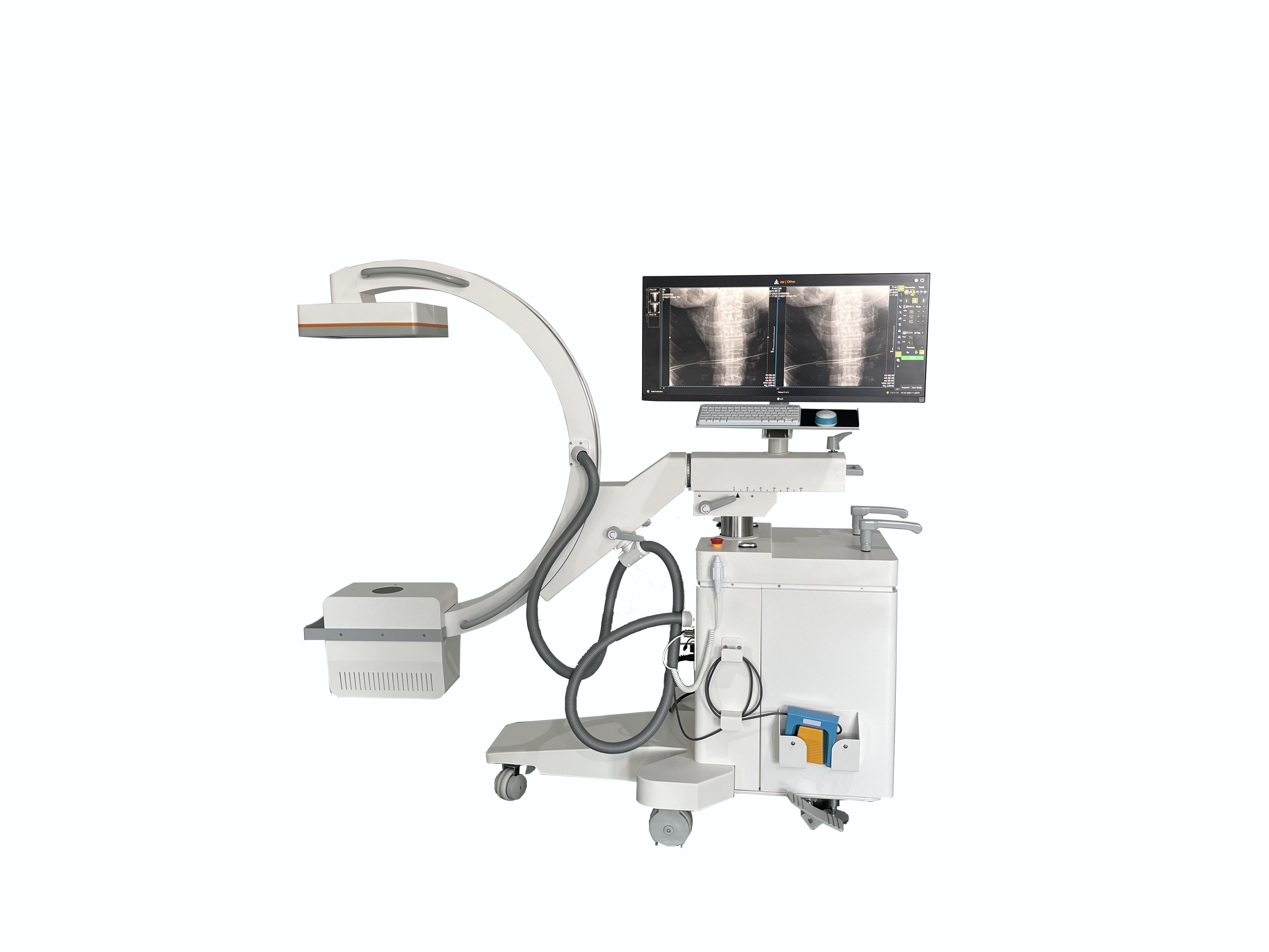 INC-15kW Mobile C-arm X-ray Machine(Flat-panel Detector)