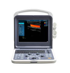 MCB-K0 Portable Ultrasound Machine