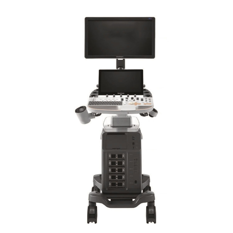 Sonoscape P60 Trolley Doppler Ultrasound