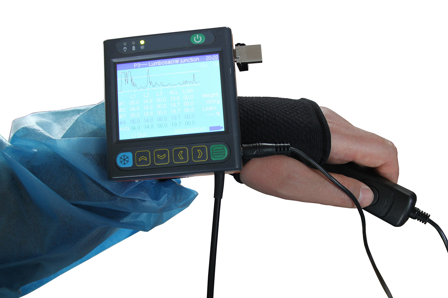 MCB-U3V Full Digital Veterinary Ultrasound