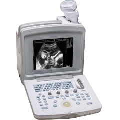 MC-180V Full Digital Animal Ultrasound Machine