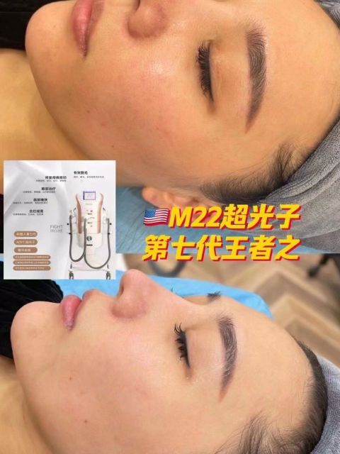 Beauty Salon Equipment portable IPL laser hair removal Tattoo Removal Skin Rejuvenation Machine M22 IPL laser machine