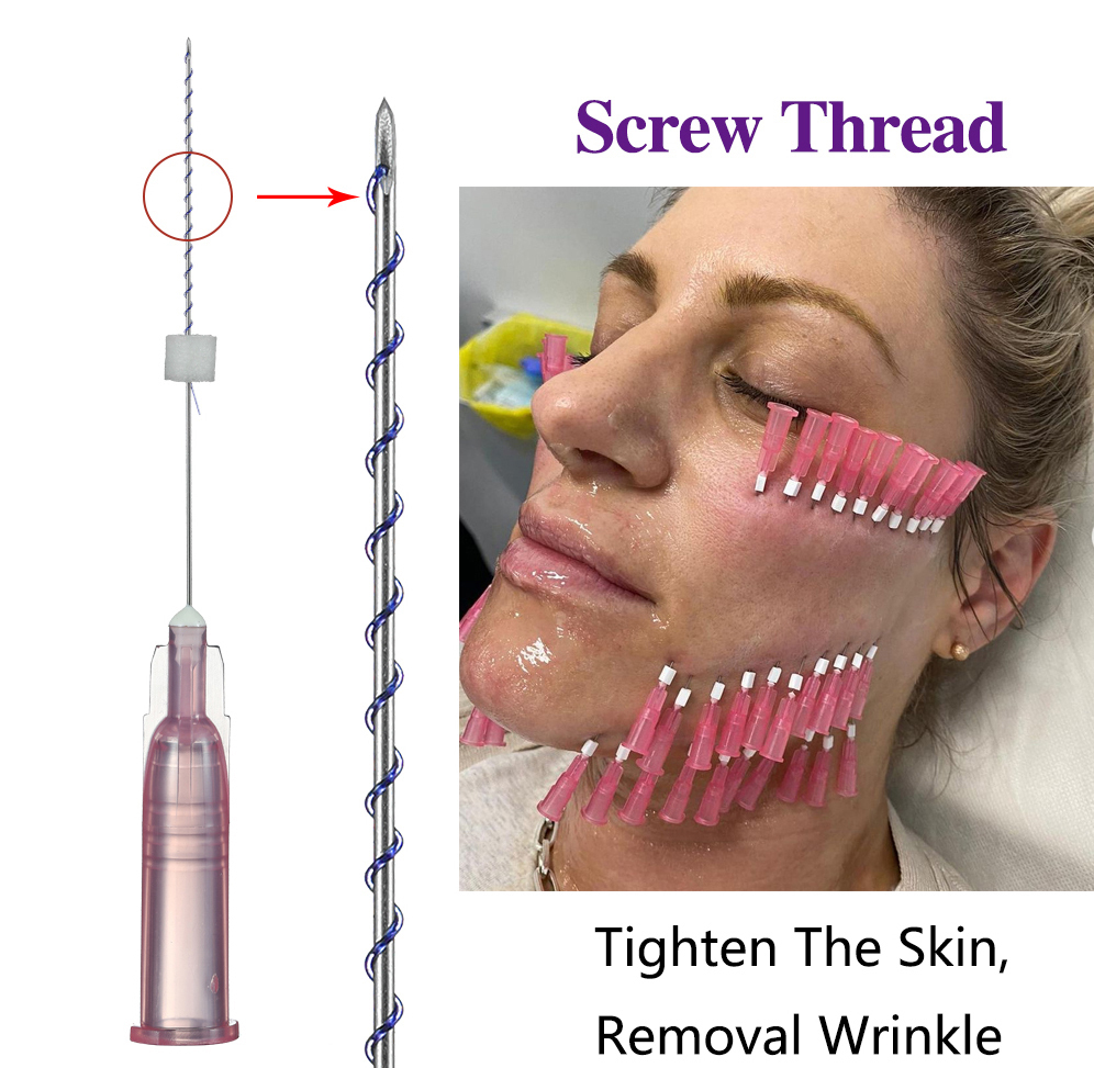 Sharp Needle Medical Face Skin Tightening Wrinkle 26g - 30g Pdo Thread Lifting Screw Pdo Thread Lift