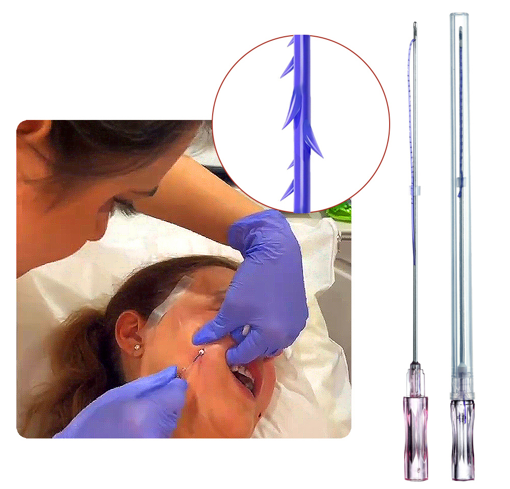 Korea Body Chin Face V Line 18g - 23g Pdo Thread Lifting Cog 360° 3d 4d 6d Pdo Cog Thread