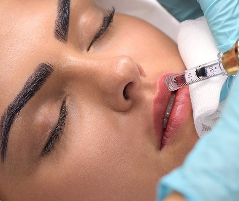 24mg/ml Fine Line Facial Wrinkles Lips Injection Ha Injectable Dermal Filler Cross Linked Hyaluronic Acid Gel
