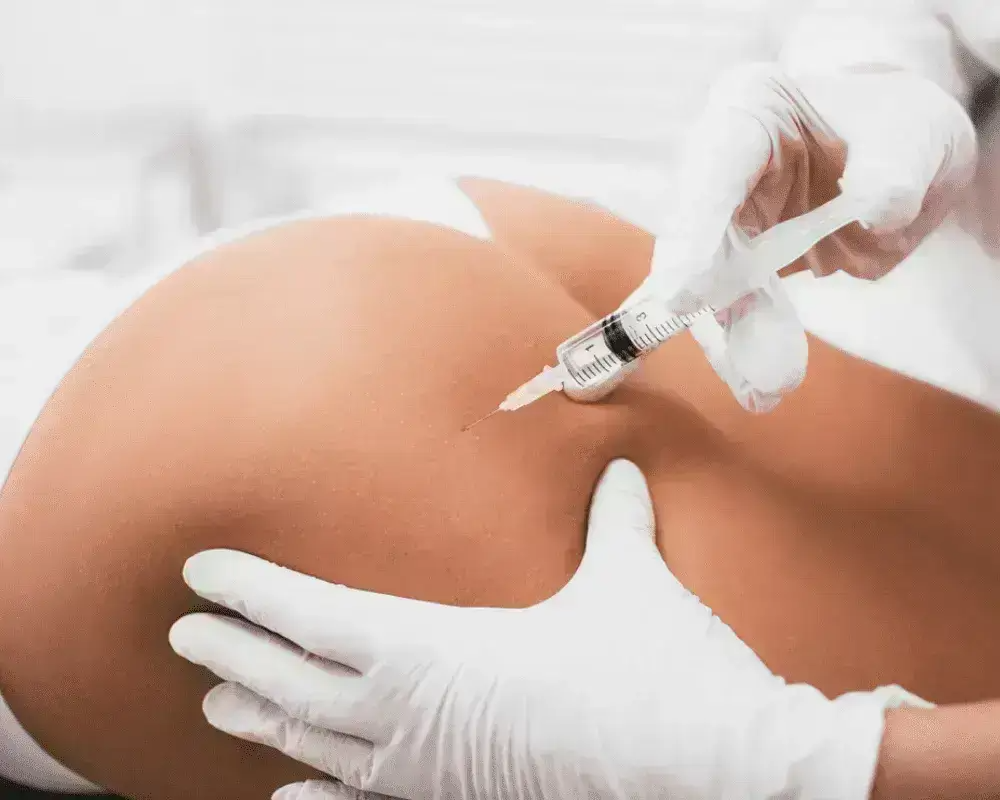24mg/ml Ultra Large Molecular Particles Ultra Deep Breast Buttock Injection Ha Injectable  Hyaluronic Acid Gel Dermal Filler