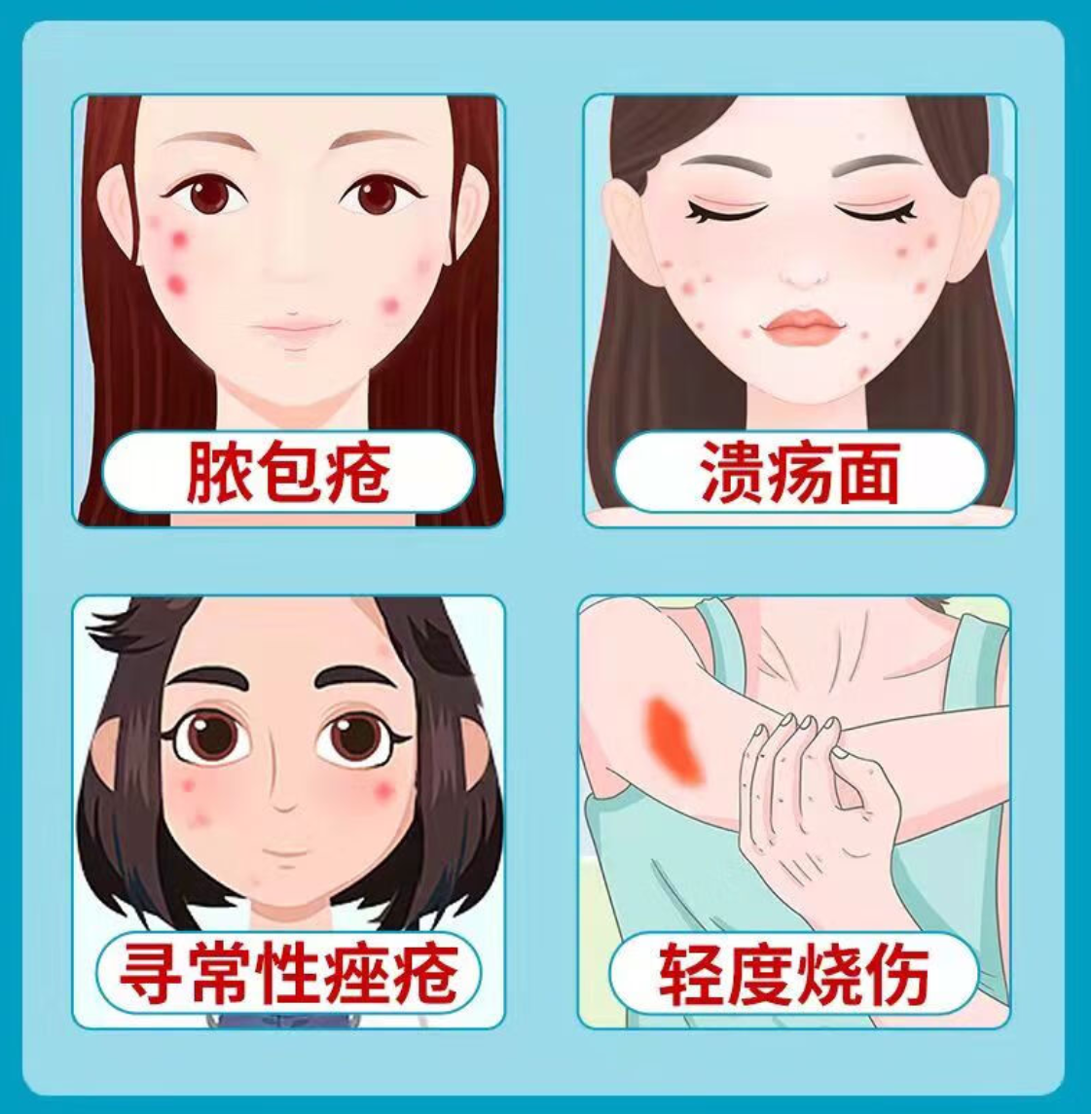 药品-消炎药-红霉素软膏