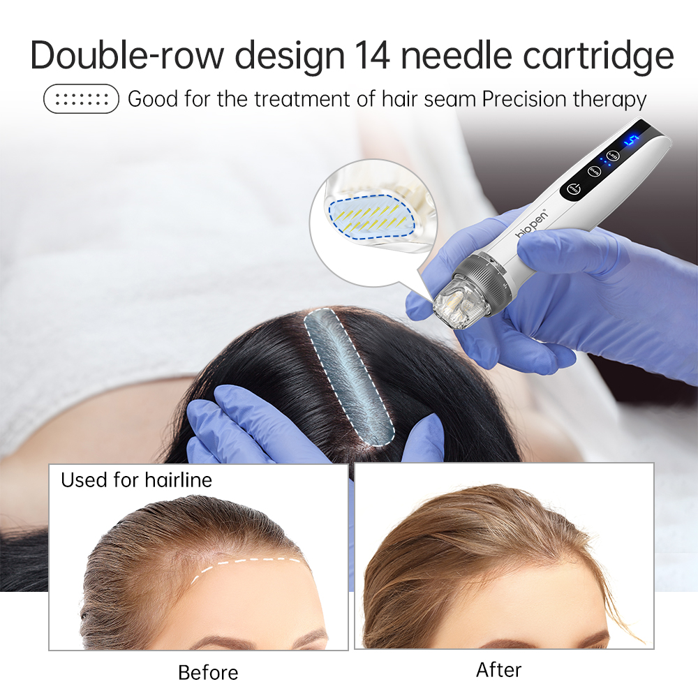 み*ぃ様 ノアグロウ 同型導入美容機器 bio pen Q2 Bio Pen Q2: Advanced Microneedling Device for Skin Rejuvenation