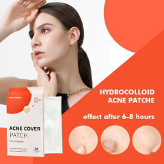 36 Count Acne Pimple Patch for Covering Zits and Blemishes