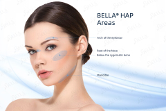 Bella HAP 1ml/syringe