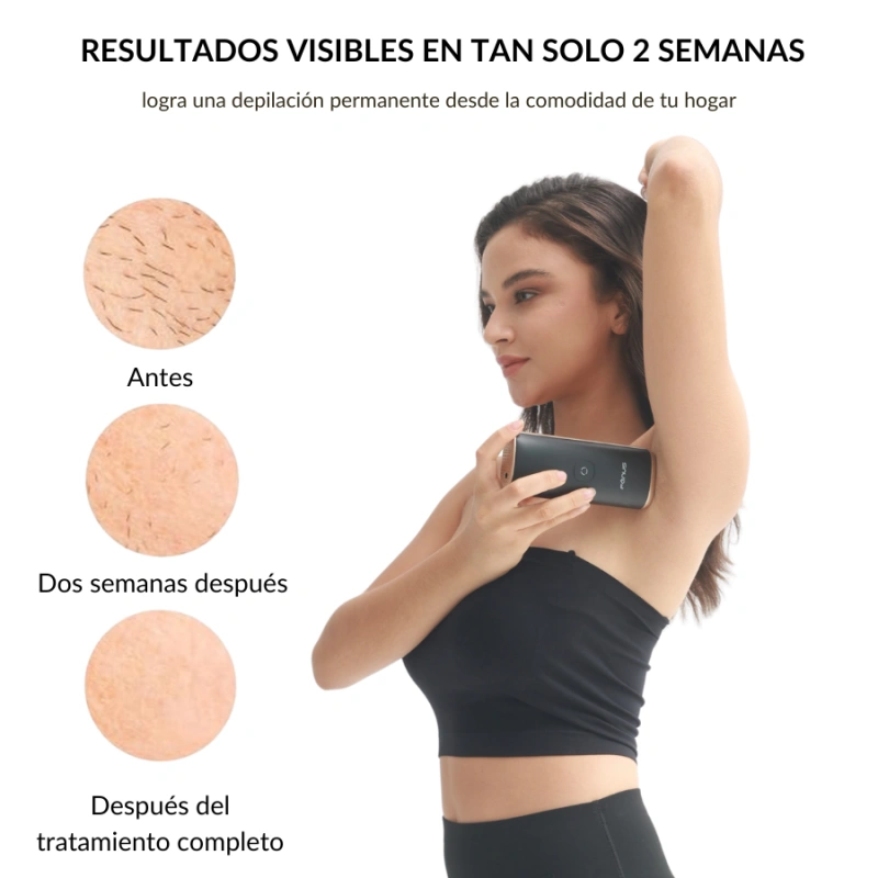 Piel DepilaciÃ³n Luz Pulsada Duele FENUS Depiladora Láser
