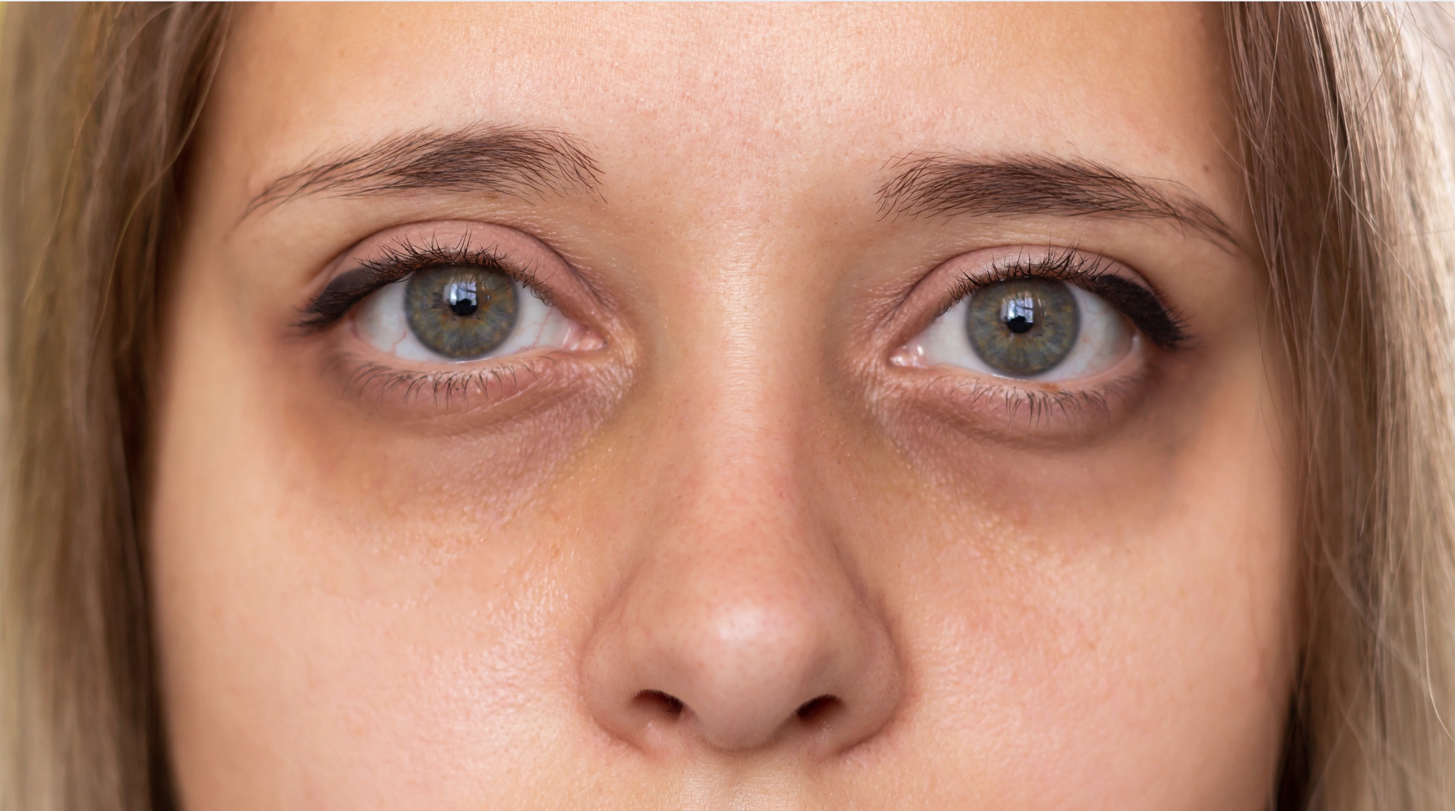 Descubre cómo la radiofrecuencia y la luz roja pueden transformar tus ojos cansados